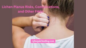 Lichen Planus Risks